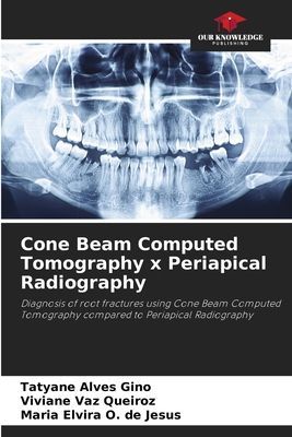 Cone Beam Computed Tomography x Periapical Radiography: Diagnosis of root fractures using Cone Beam Computed Tomography compared to Periapical Radiography
