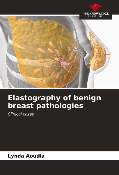 Elastography of benign breast pathologies: Clinical cases