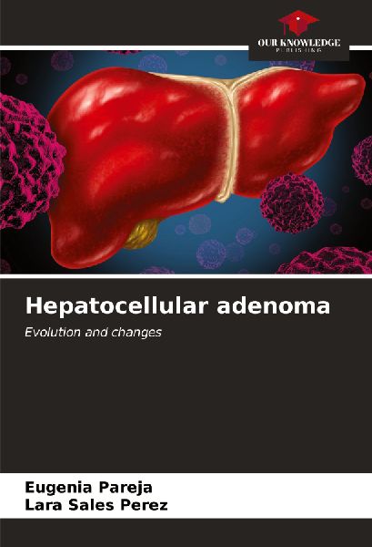 Hepatocellular adenoma: Evolution and changes