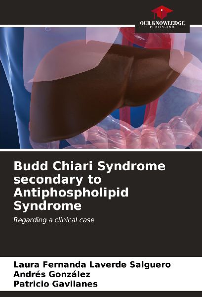 Budd Chiari Syndrome secondary to Antiphospholipid Syndrome: Regarding a clinical case