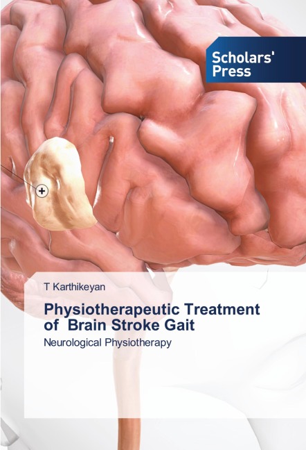 Physiotherapeutic Treatment of Brain Stroke Gait: Neurological Physiotherapy