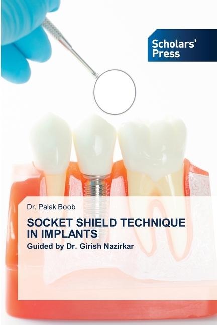 SOCKET SHIELD TECHNIQUE IN IMPLANTS: Guided by Dr. Girish Nazirkar