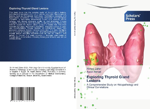 Exploring Thyroid Gland Lesions: A Comprehensive Study on Histopathology and Clinical Correlations