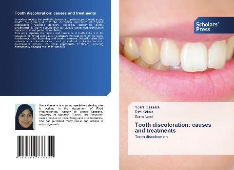 Tooth discoloration: causes and treatments: Tooth discoloration