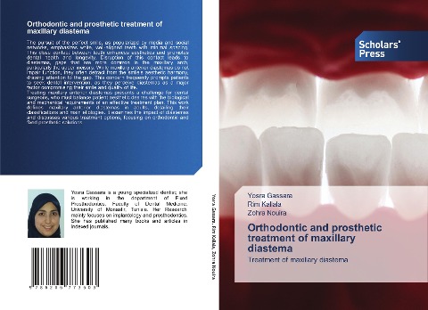 Orthodontic and prosthetic treatment of maxillary diastema: Treatment of maxillary diastema