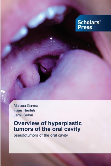Overview of hyperplastic tumors of the oral cavity: pseudotumors of the oral cavity