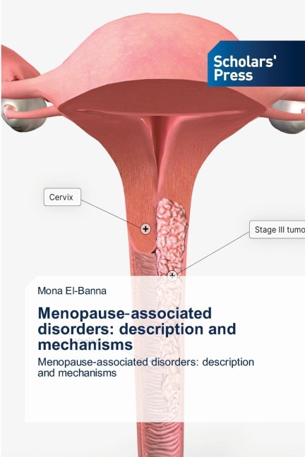 Menopause¿associated disorders: description and mechanisms: Menopause¿associated disorders: description and mechanisms