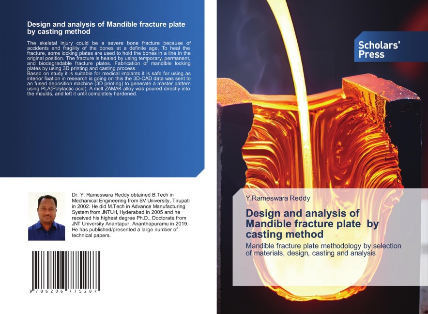 Design and analysis of Mandible fracture plate by casting method: Mandible fracture plate methodology by selection of materials, design, casting and analysis