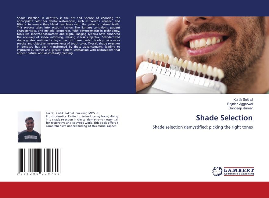 Shade Selection: Shade selection demystified: picking the right tones
