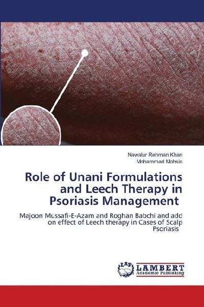 Role of Unani Formulations and Leech Therapy in Psoriasis Management: Majoon Mussafi-E-Azam and Roghan Babchi and add on effect of Leech therapy in Cases of Scalp Psoriasis