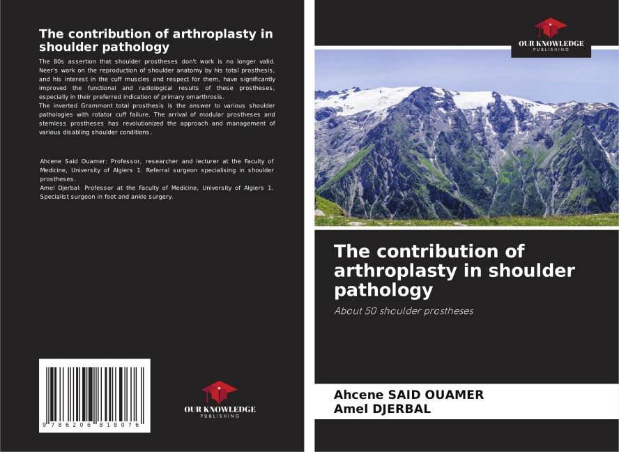 The contribution of arthroplasty in shoulder pathology: About 50 shoulder prostheses