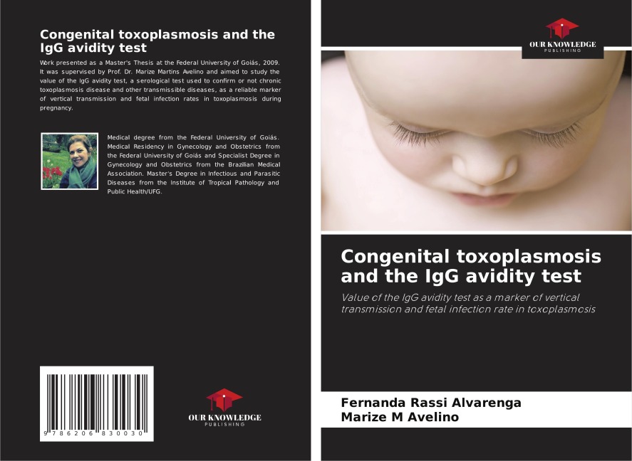 Congenital toxoplasmosis and the IgG avidity test: Value of the IgG avidity test as a marker of vertical transmission and fetal infection rate in toxoplasmosis