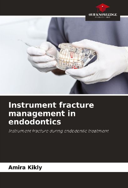 Instrument fracture management in endodontics: Instrument fracture during endodontic treatment