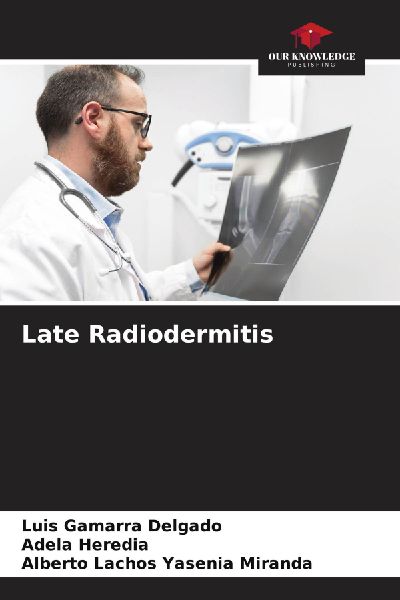 Late Radiodermitis