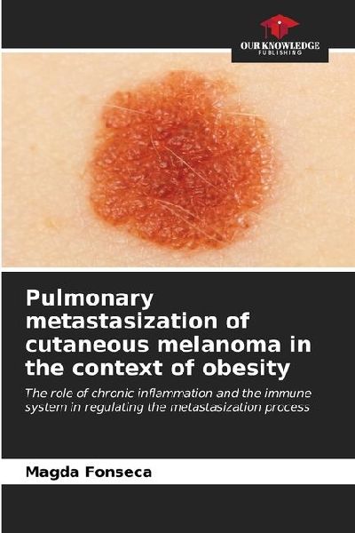 Pulmonary metastasization of cutaneous melanoma in the context of obesity: The role of chronic inflammation and the immune system in regulating the metastasization process