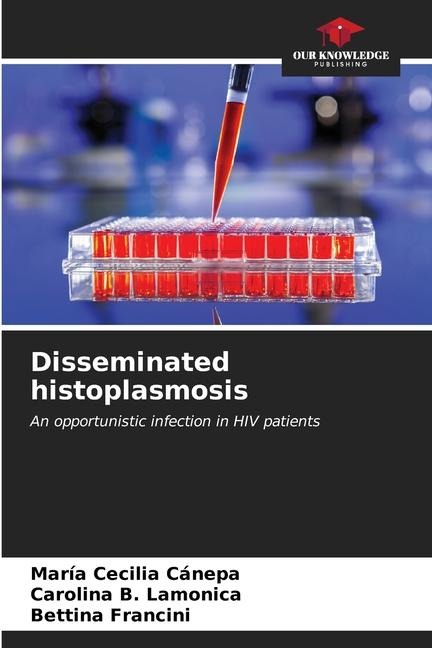 Disseminated histoplasmosis: An opportunistic infection in HIV patients