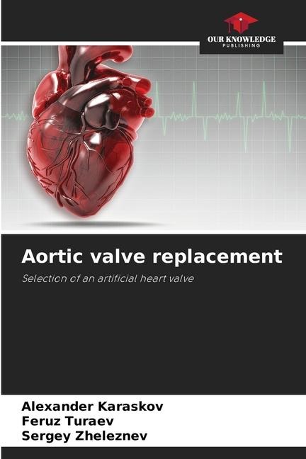 Aortic valve replacement: Selection of an artificial heart valve