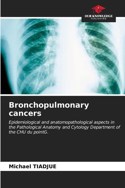 Bronchopulmonary cancers: Epidemiological and anatomopathological aspects in the Pathological Anatomy and Cytology Department of the CHU du pointG.