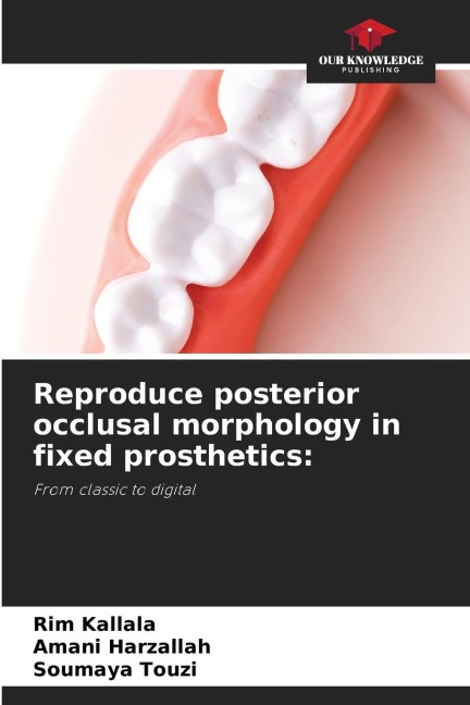 Reproduce posterior occlusal morphology in fixed prosthetics:: From classic to digital