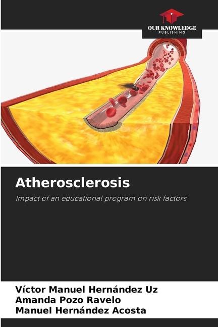 Atherosclerosis: Impact of an educational program on risk factors