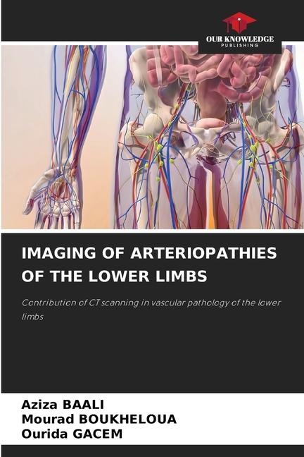 IMAGING OF ARTERIOPATHIES OF THE LOWER LIMBS: Contribution of CT scanning in vascular pathology of the lower limbs