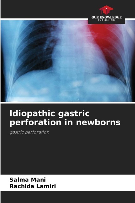 Idiopathic gastric perforation in newborns: gastric perforation