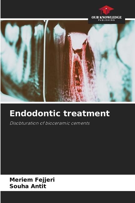 Endodontic treatment: Disobturation of bioceramic cements