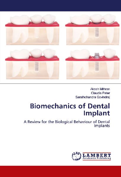 Biomechanics of Dental Implant: A Review for the Biological Behaviour of Dental Implants