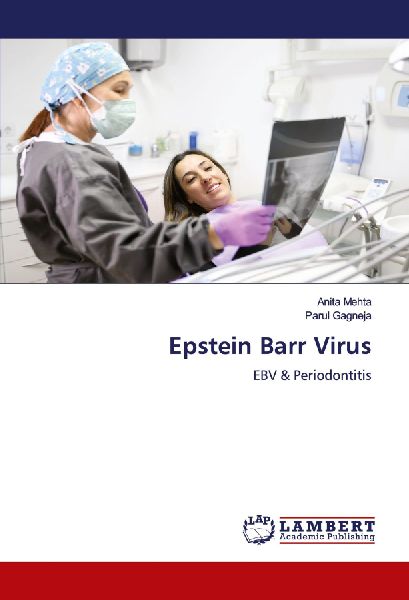 Epstein Barr Virus: EBV & Periodontitis