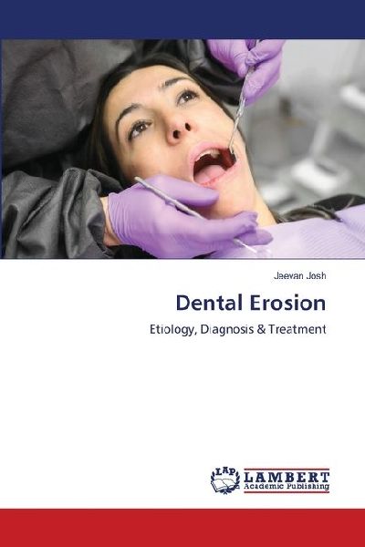 Dental Erosion: Etiology, Diagnosis & Treatment