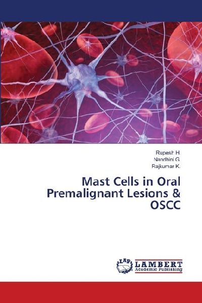 Mast Cells in Oral Premalignant Lesions & OSCC