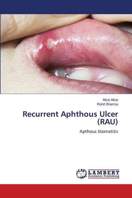 Recurrent Aphthous Ulcer (RAU): Apthous Stomatitis