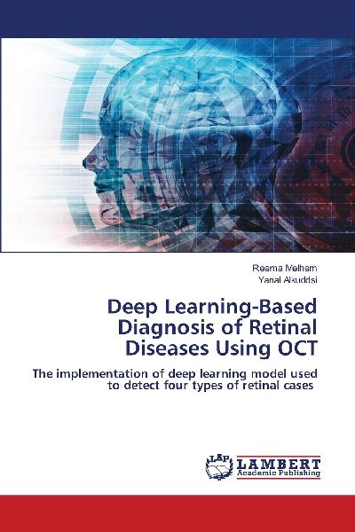 Deep Learning-Based Diagnosis of Retinal Diseases Using OCT: The implementation of deep learning model used to detect four types of retinal cases