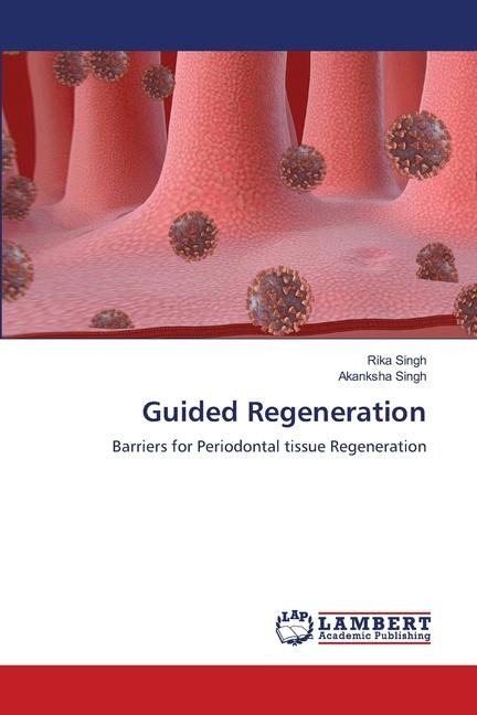 Guided Regeneration: Barriers for Periodontal tissue Regeneration