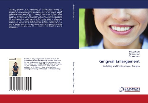 Gingival Enlargement: Sculpting and Contouring of Gingiva