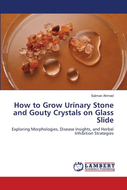 How to Grow Urinary Stone and Gouty Crystals on Glass Slide: Exploring Morphologies, Disease Insights, and Herbal Inhibition Strategies
