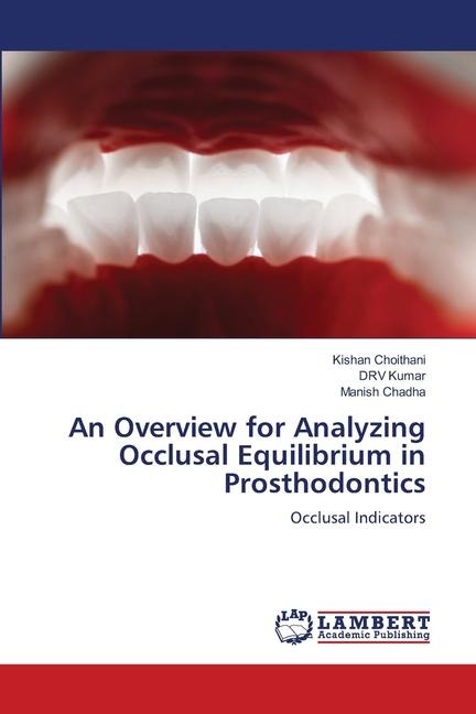 An Overview for Analyzing Occlusal Equilibrium in Prosthodontics: Occlusal Indicators