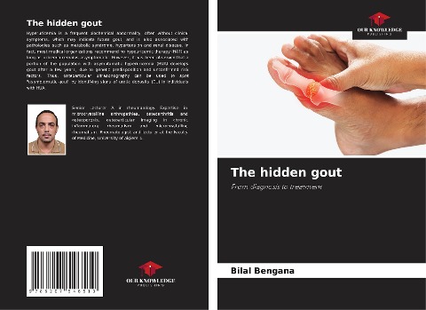 The hidden gout: From diagnosis to treatment