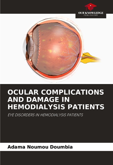 OCULAR COMPLICATIONS AND DAMAGE IN HEMODIALYSIS PATIENTS: EYE DISORDERS IN HEMODIALYSIS PATIENTS