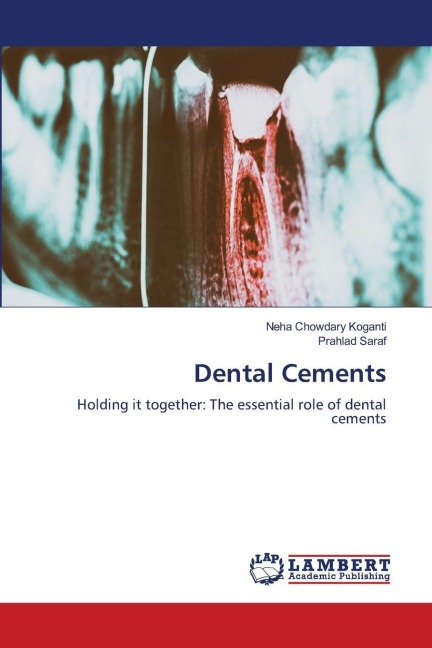 Dental Cements: Holding it together: The essential role of dental cements