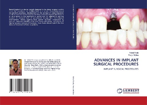 ADVANCES IN IMPLANT SURGICAL PROCEDURES: IMPLANT SURGICAL PROCEDURES