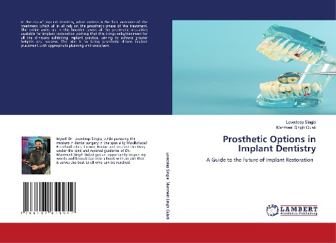 Prosthetic Options in Implant Dentistry: A Guide to the Future of Implant Restoration
