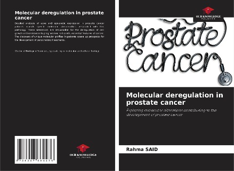 Molecular deregulation in prostate cancer: Exploring molecular alterations contributing to the development of prostate cancer