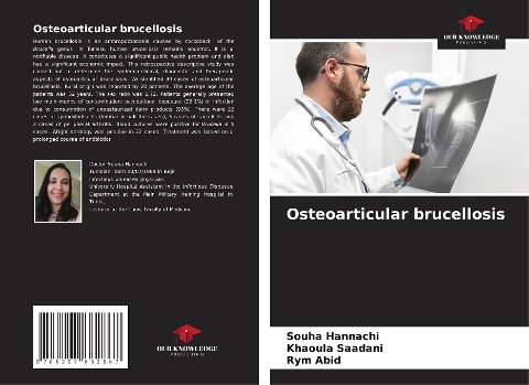 Osteoarticular brucellosis