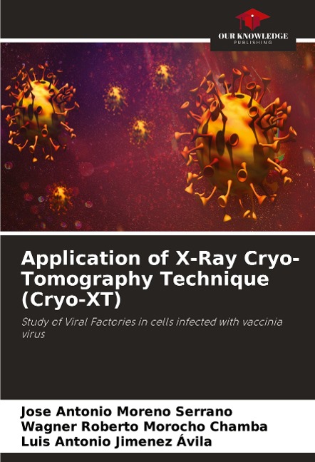 Application of X-Ray Cryo-Tomography Technique (Cryo-XT): Study of Viral Factories in cells infected with vaccinia virus