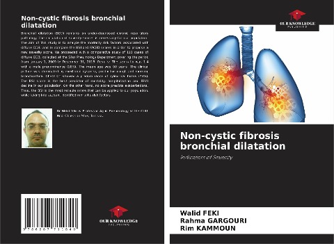 Non-cystic fibrosis bronchial dilatation: Indicators of Severity