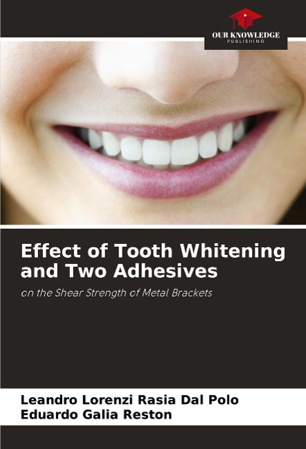 Effect of Tooth Whitening and Two Adhesives: on the Shear Strength of Metal Brackets