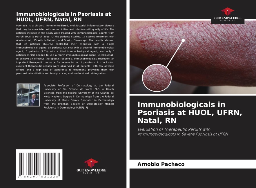 Immunobiologicals in Psoriasis at HUOL, UFRN, Natal, RN: Evaluation of Therapeutic Results with Immunobiologicals in Severe Psoriasis at UFRN