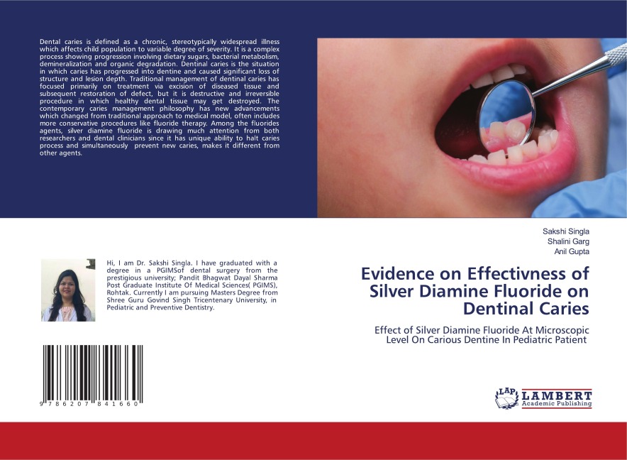 Evidence on Effectivness of Silver Diamine Fluoride on Dentinal Caries: Effect of Silver Diamine Fluoride At Microscopic Level On Carious Dentine In Pediatric Patient