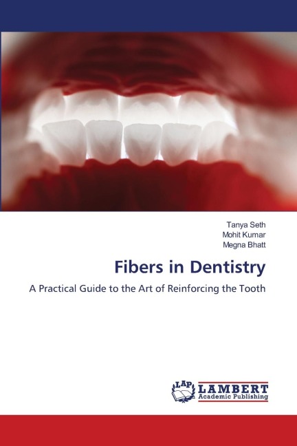 Fibers in Dentistry: A Practical Guide to the Art of Reinforcing the Tooth